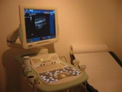 Diagnostischer Ultraschall der neuesten Generation